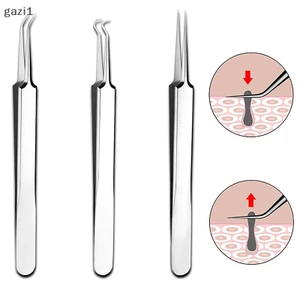 Nhíp Gắp Mụn Đầu Đen Làm Đẹp 8cm