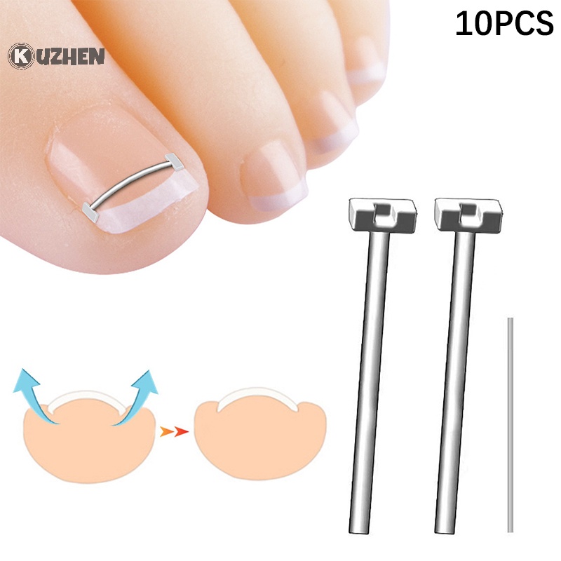 Dụng Cụ Chỉnh Hình Móng Chân Mọc Ngược Chuyên Nghiệp