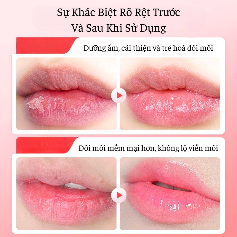 Son Dưỡng Môi Honyuan Vitamin E, Tinh Chất Dưỡng Môi Hoa Đào, Chống Nứt Nẻ Khô Môi, Dưỡng Ẩm & Làm Mờ Viền Môi, Giúp Đôi
