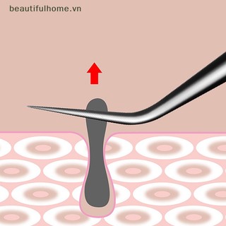 Nhíp 8cm để chiết xuất mụn đầu đen để làm đẹp