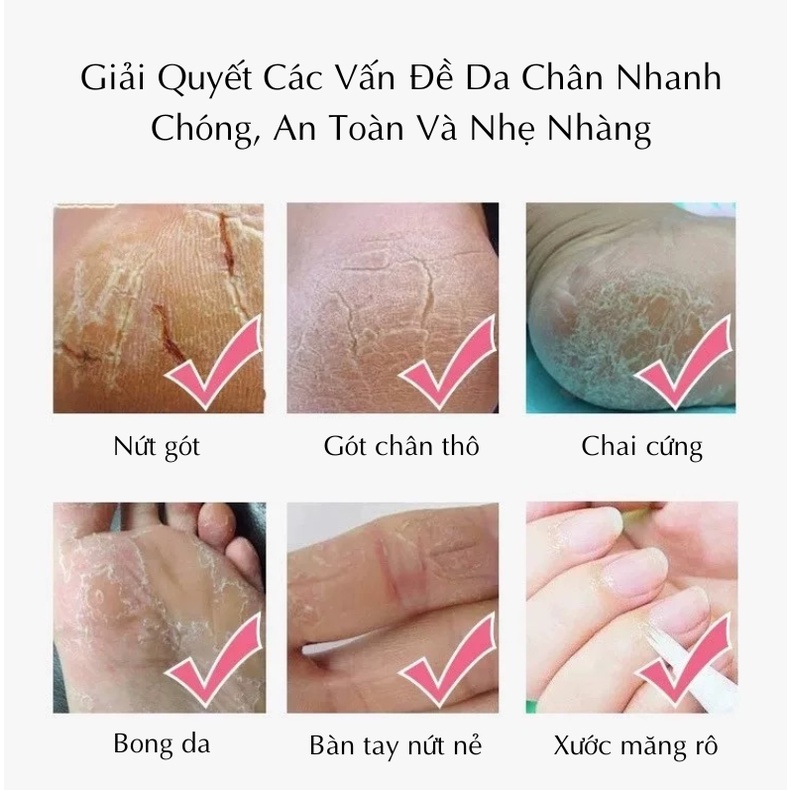 Kem Dưỡng Da Chân Vitamin E Giúp Dưỡng Ẩm, Chống Nứt Nẻ, Khô Ráp, Chai Sần, Hồi Phục Gót Chân Nứt Nẻ, Dưỡng Da Mềm Mịn