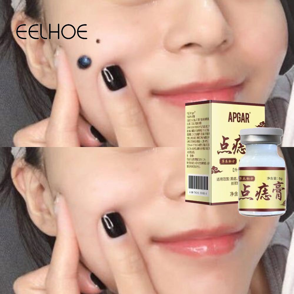 Ảnh EELHOE Da Tẩy Nốt Ruồi Kem Không Dấu Vết Loại Bỏ Flat Eugene Mượt Nhọn Thịt Gai 1
