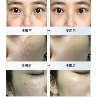 Kem bôi đồi mồi thảo dược Dr.Li - Kem bôi nám, tàn nhang, đồi mồi, dùng được cho tay và mặt Dr.Li, dưỡng da trắng sáng
