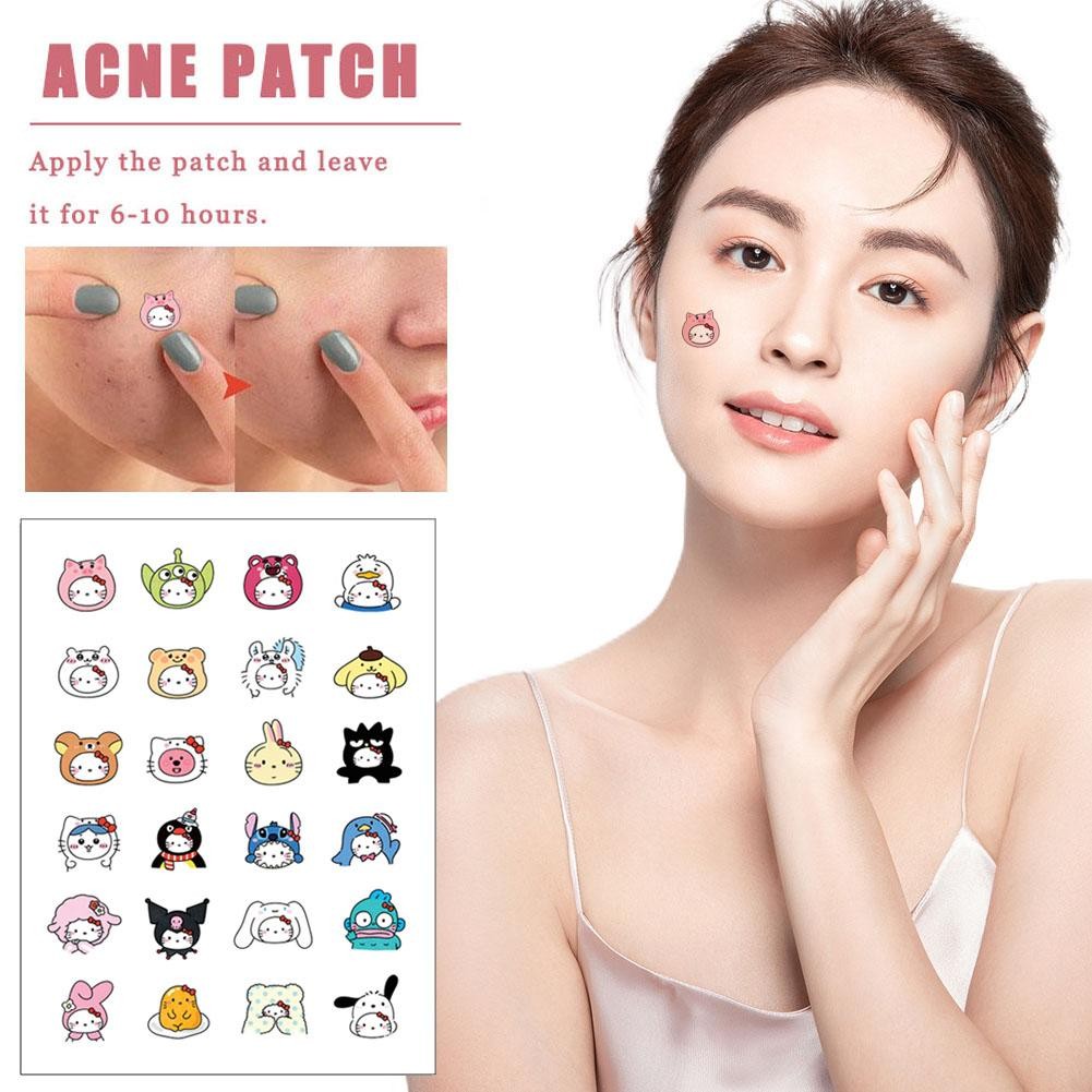 Tấm Hello Kitty Acne Patch Cover Patch Sanlio Acne Cartoon Patch Series O4e2