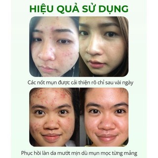 Tinh Chất Serum Black Ginseng Nhân Sâm Đen LUNYS, Dưỡng Trắng Da, Mờ Thâm Sạm, Hỗ Trợ Da Trẻ Trung