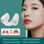 NORDICLIFE Silica Gel Mũi Kẹp, Hỗ Trợ Định Hình Silicon Sau phẫu thuật Định Hình Nostril Hỗ Trợ Định Hình, Điều Chỉnh Chỉnh Chỉnh Mũi Mũi Mũi Hình Xoay