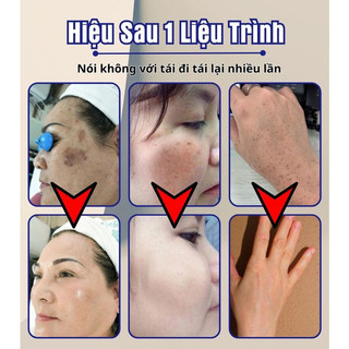 Kem bôi đồi mồi thảo dược Dr.Li - Kem bôi nám, tàn nhang, đồi mồi, dùng được cho tay và mặt Dr.Li, dưỡng da trắng sáng
