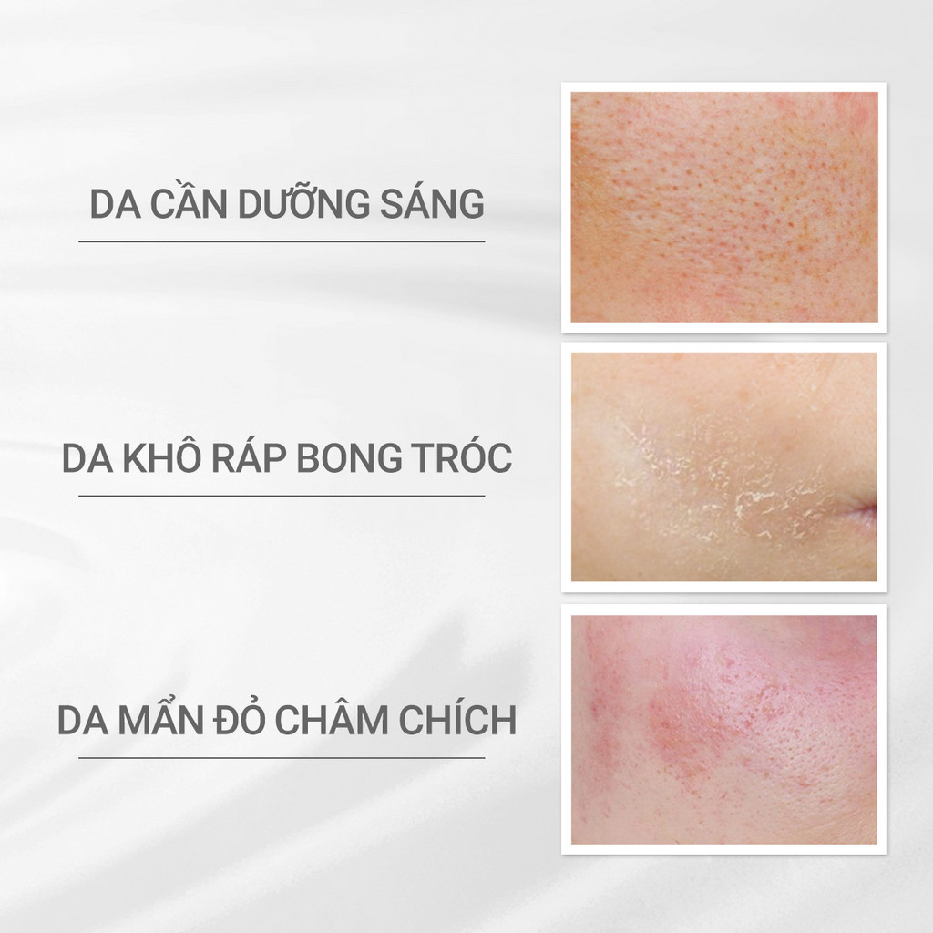 Ảnh Nước cân bằng dưỡng trắng cho da nhạy cảm Dprogram Microbiome Brightening Clear Lotion 125ml 3