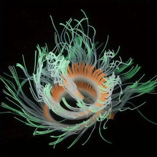 Glow-in-the-dark Silicone Biển Anemone Mô Phỏng San Hô, Trang Trí Bể Cá Dạ Quang Cho Cảnh Quan Bể Cá