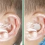Hik 20 40 100 Chiếc Chống Thấm Nước Bảo Vệ Tai Dán Bơi Bao Tai Mũ Tắm Cho Bé Bảo Vệ Tai Miếng Dán Tắm