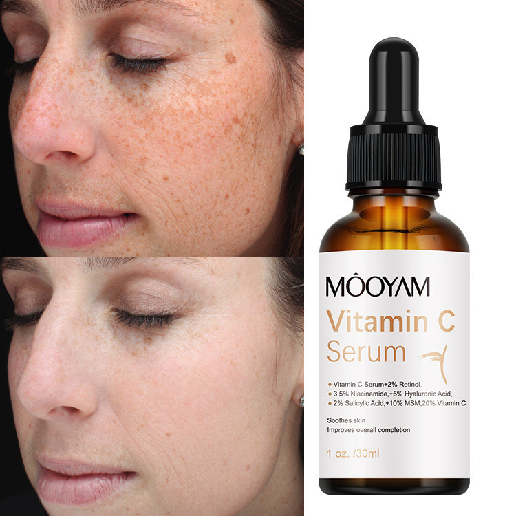 Serum Vitamin C MOOYAM Hết Sạm Đốm Da, Trắng Da, Chống Lão Hóa Làm Mờ Nếp Nhăn Giúp Da Đàn Hồi 30ml