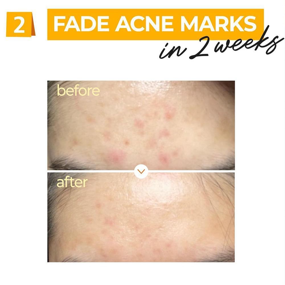 30ml 5 + Vitamin Serum Cô Đặc Điểm Phai Màu Và Dưỡng Ẩm Da B7r1