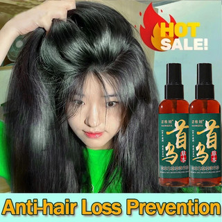 Xịt mọc tóc 100ML ngăn ngừa rụng tóc, chống hói đầu cho nam nữ