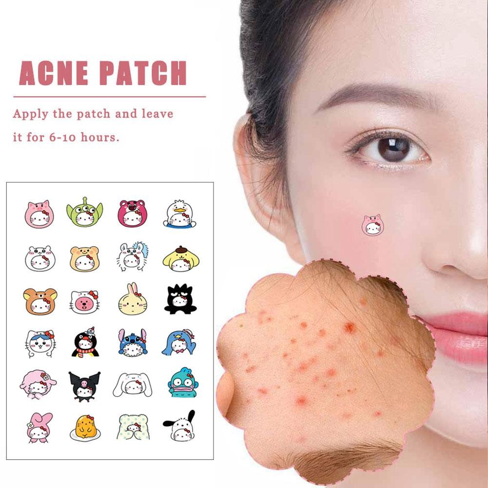 Tấm Hello Kitty Acne Patch Cover Patch Sanlio Acne Cartoon Patch Series O4e2