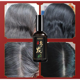 Tinh chất thảo dược Bai Kon - Tinh chất xịt đen tóc, cải thiện tóc bạc, tóc xơ yếu, kích mọc tóc, ngăn ngừa rụng tóc
