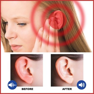 Xịt giảm ù tai Tai Ringing Relief Chống ù tai Loại bỏ ráy tai 2Oz Thuốc nhỏ tai cho trẻ em Người lớn Đau tai Thuốc tẩy sáp tai fotvn