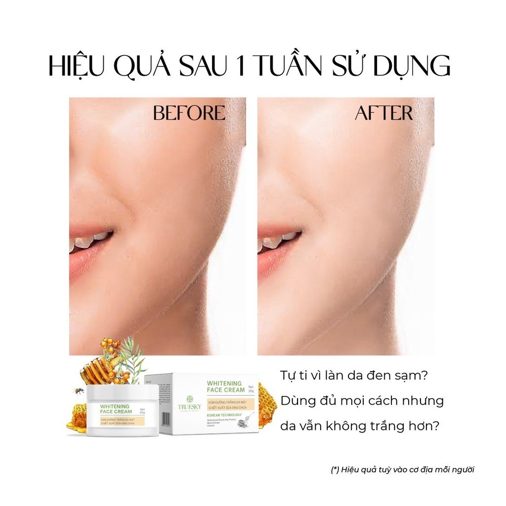 (Thử 5g) Kem dưỡng trắng da mặt chiết xuất sữa ong chúa Truesky Whitening Face Cream 20g