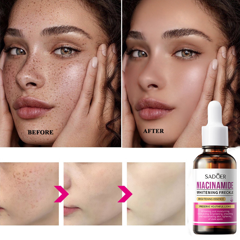 Niacinamide tinh chất làm trắng làm trắng da mặt tinh chất tàn nhang 30ml làm sáng màu da cải thiện sắc tố và đốm đen nu
