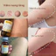 Kela Lotion Thái Lan Giảm Viêm Nang Lông Hiệu Quả 30ml - 60ml