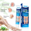 Sumifun Kem Suy Giãn Tĩnh Mạch Giúp Giảm Đau Mỏi, Mất Thẩm Mỹ Do Suy Giãn Tĩnh Mạch Gây Ra