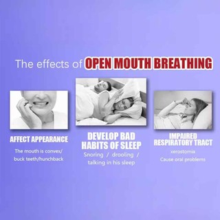​Noctivio Anti Snoring Mouth Tape Nose Breathing Improving Reduce Mouth Dryness Better Sleeping Closed Mouth Stickers