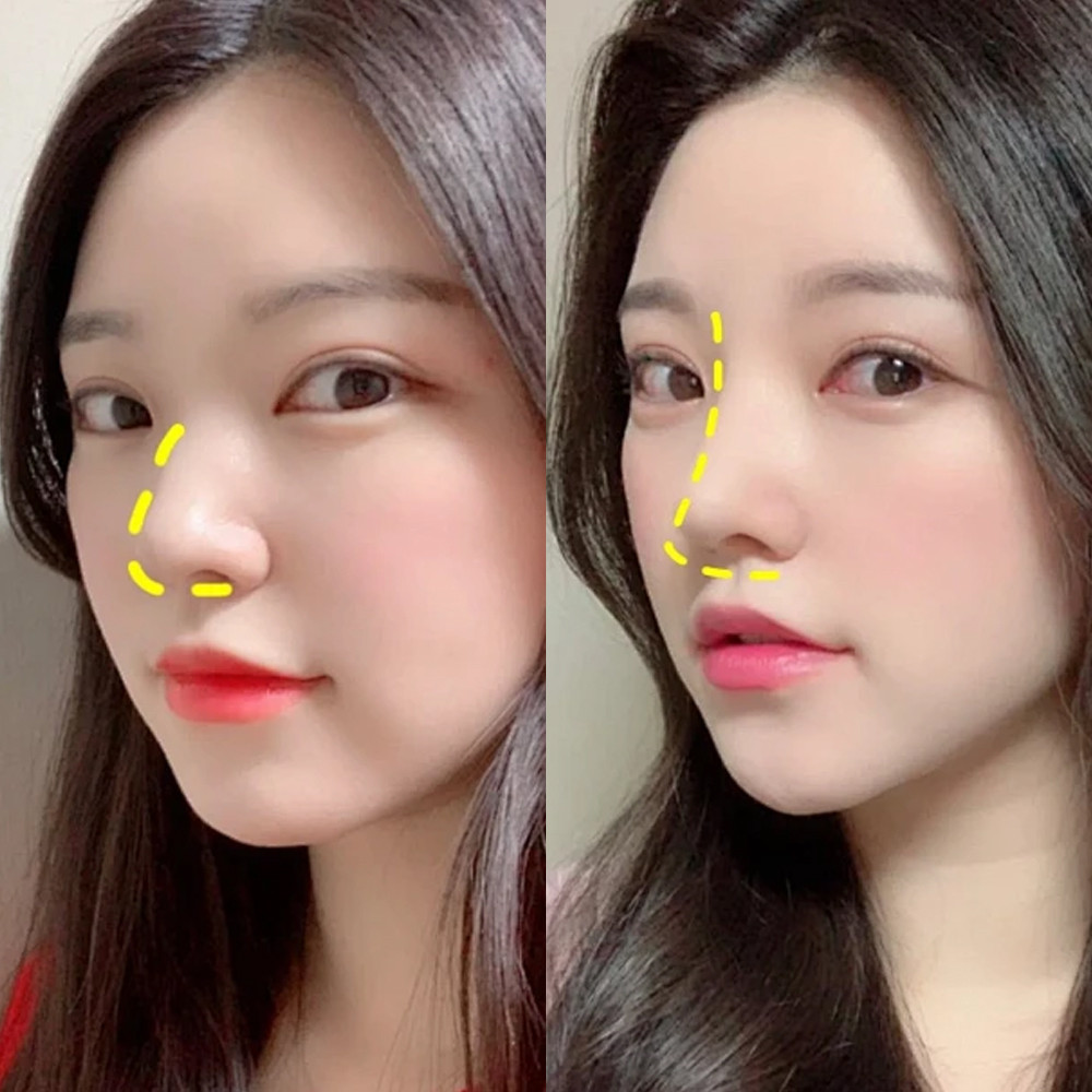 1 / 3 / 5 Cái Nẹp mũi nhựa nhiệt dẻo nhiệt độ thấp - Dụng cụ chỉnh chiều cao cầu kẹp mũi thoáng khí - Dụng cụ chăm sóc sắc đẹp