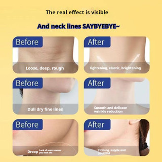 Kem cổ Sdx Sdx 🍎 Kem dưỡng ẩm cổ để nâng làm săn chắc đường cong dưỡng ẩm Massage bóng và Kem làm mờ cổ Kem chăm sóc cổ
