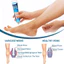 Sumifun Kem Suy Giãn Tĩnh Mạch Giúp Giảm Đau Mỏi, Mất Thẩm Mỹ Do Suy Giãn Tĩnh Mạch Gây Ra