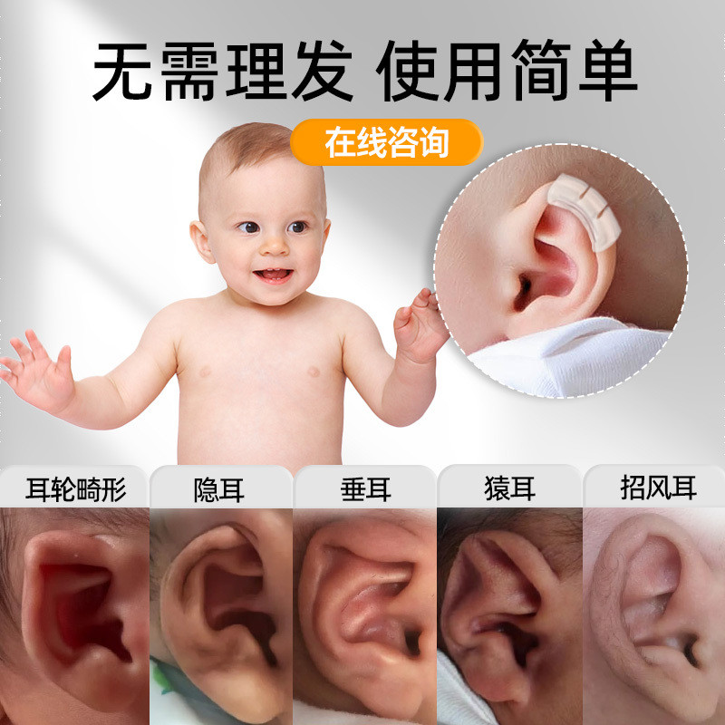 Tai Thoải Mái Định Hình Bé Chỉnh Sửa Dụng Cụ Tiện Dụng Hỗ Trợ Tai 3.19 Chất Liệu Sơ Sinh Hiệu Chỉnh Aurile Mềm Corrector Kẹp Tai Lop Tai Silicon