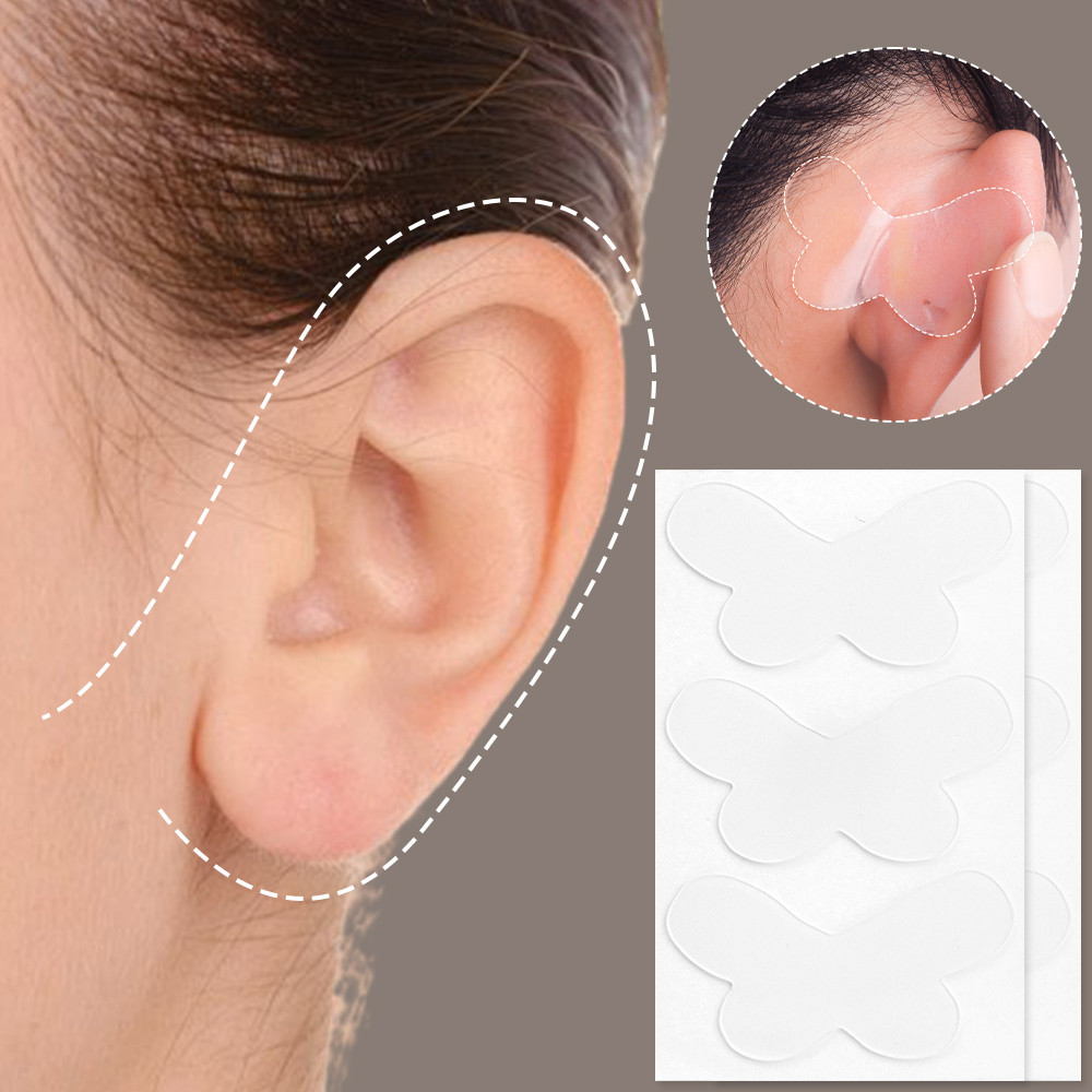 42 Miếng Dán Tai Yêu Tinh Hình Bướm - Miếng Dán Chỉnh Tai Silicon - Ủng Hộ Đôi Tai Lớn - Chống Thấm Nước, Tự Dính - Băng Tai Nữ Làm Đẹp