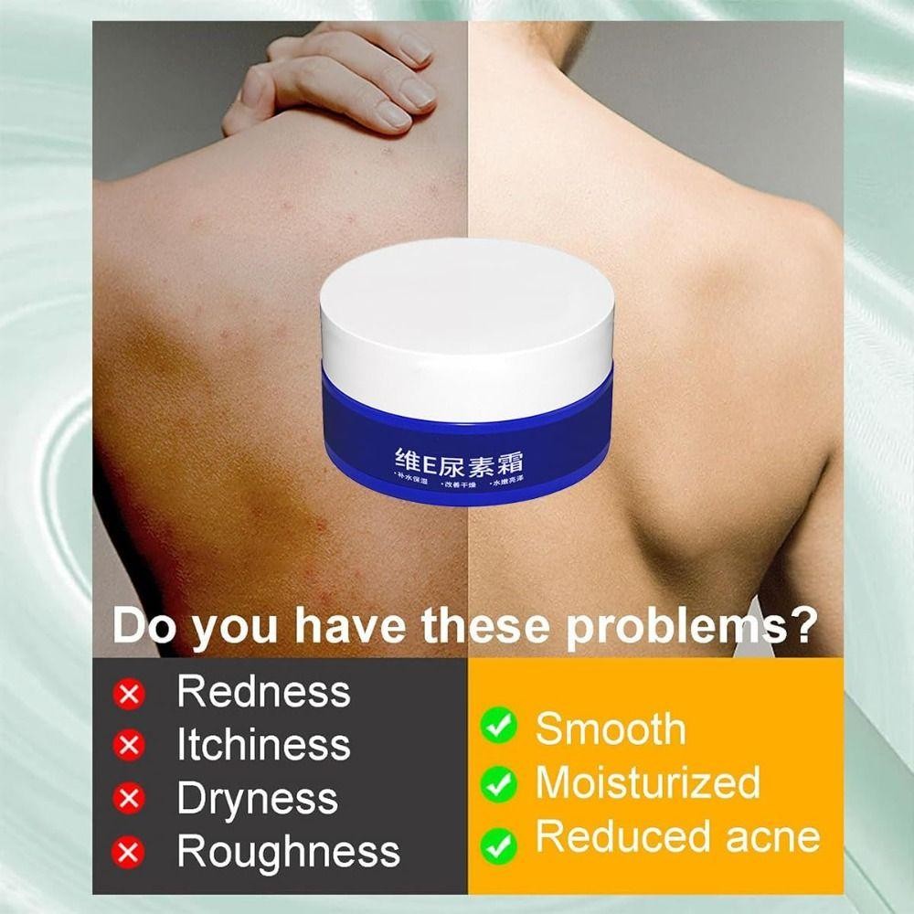 Kem dưỡng da mặt FAVORITEGOODS, Điểm cũ và đốm vàng Kem dưỡng trắng làm trắng vết thâm, Giảm nóng mắt cá chân ngay cả tông màu da Loại bỏ tàn nhang Mặt Kem dưỡng ẩm Chăm sóc da
