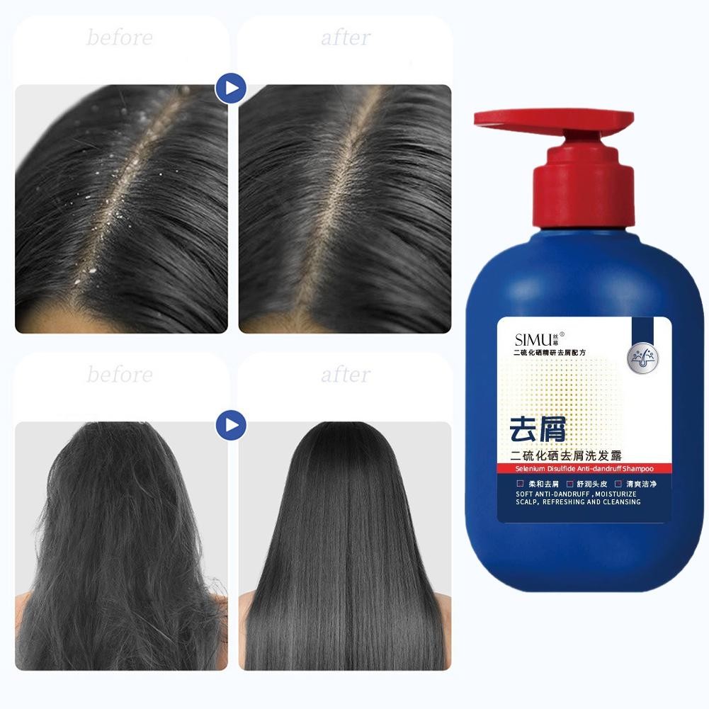 300ml Dầu gội loại bỏ gàu Selenium Disulfide, Dầu gội làm mới và mịn màng M7h4