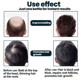 [ TN ] Dung Dịch Mọc Râu Và Tóc Hiệu Quả Của Mỹ Minoxidil 5% Kirk-land 6x60ml