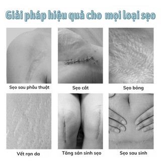 Kem Bôi Mờ Sẹo Mờ Thâm SCAR DISAPPEARS LANEMAY Giúp Làm Mờ Sẹo Rỗ Sẹo Lõm Sẹo Lâu Năm