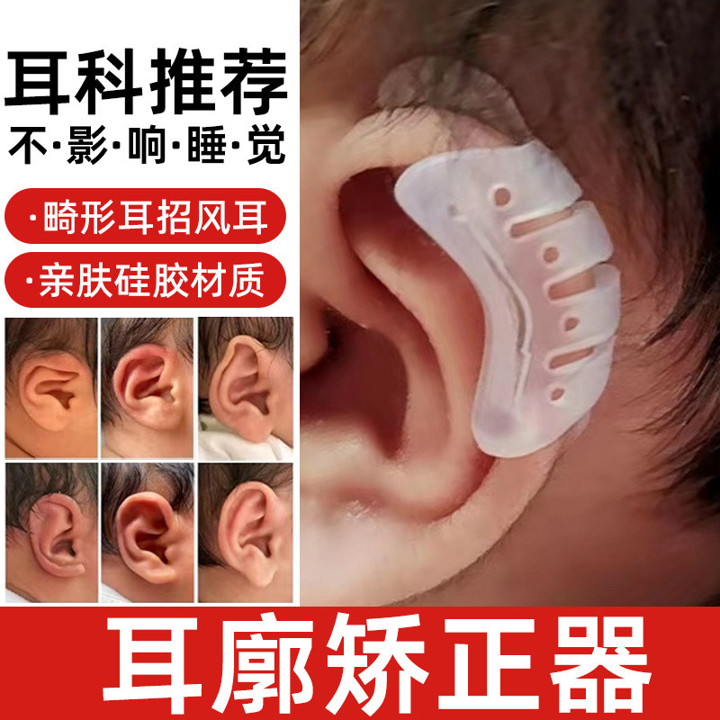 Auricle Correction 3.19 Biến Dạng Tai Sơ Sinh Chỉnh Sửa Tai Bé Lop Hình Tai Định Hình Corrector