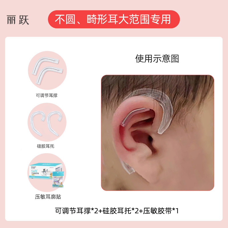 Auricle Correction 3.19 Biến Dạng Tai Sơ Sinh Chỉnh Sửa Tai Bé Lop Hình Tai Định Hình Corrector