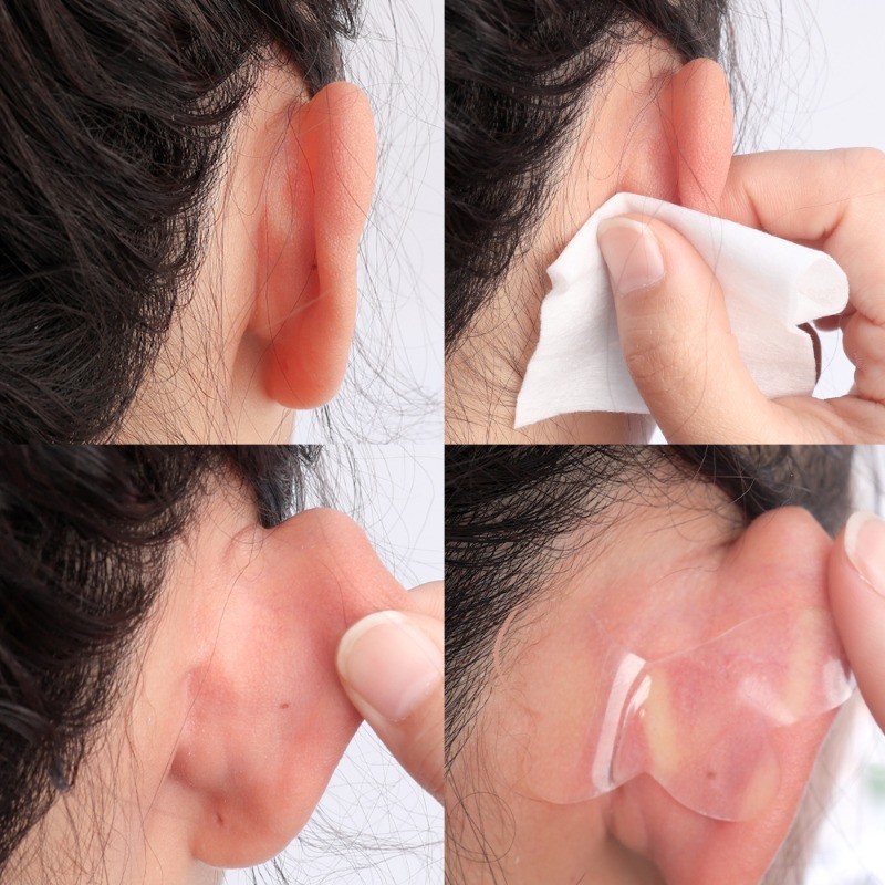[Nổi bật] Nhãn dán tai Elf - Dụng cụ chỉnh tai - Miếng dán hình con bướm - Hỗ trợ tai - Tự dính, Vô hình, Chống mồ hôi - Băng cố định tai - Dụng cụ làm đẹp - Phụ kiện trang điểm