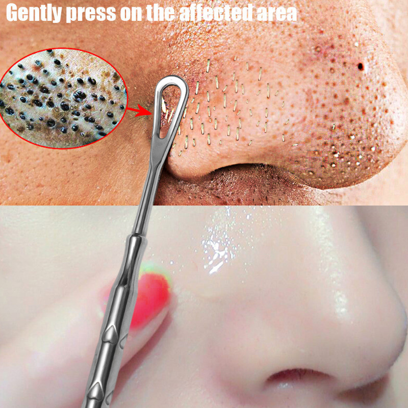 Đẩy mụn đầu đen mũi - Thép không gỉ, Hai đầu - Đa năng, Di động, Chất lượng cao - Vệ sinh cạo mặt - Kim Hỗ trợ giảm mụn - Dụng cụ loại bỏ mụn đầu đen da chết