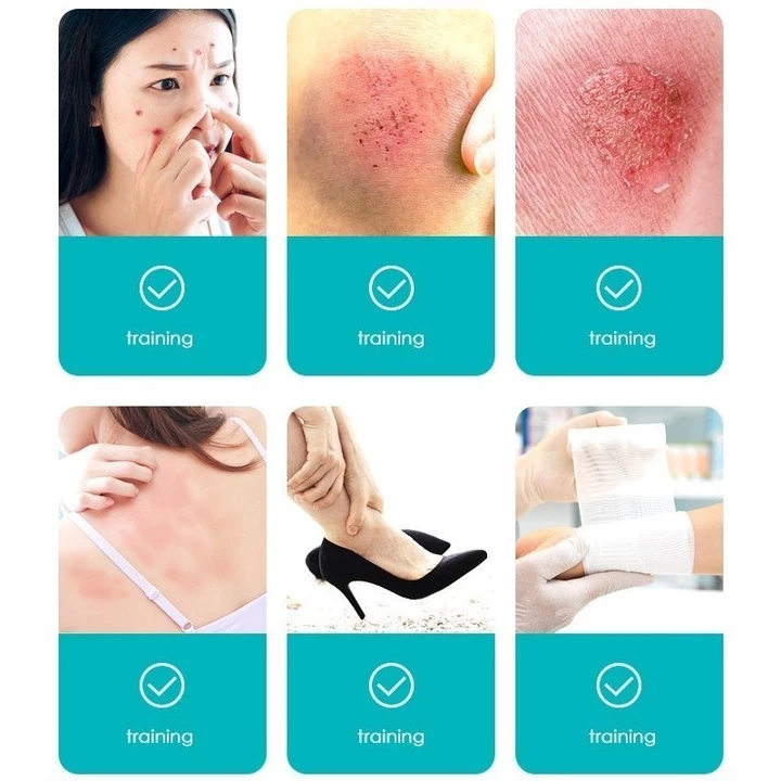 Acne Cleansing Clear Patch Hydrocolloid – 5