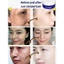 TOPTOOLCX Spot Fade Urea Cream, Loại bỏ tàn nhang Giảm vết thâm Kem dưỡng da mặt, Làm trắng da ngay cả tông màu da Giảm quầng thâm Kem dưỡng ẩm mặt Chăm sóc da