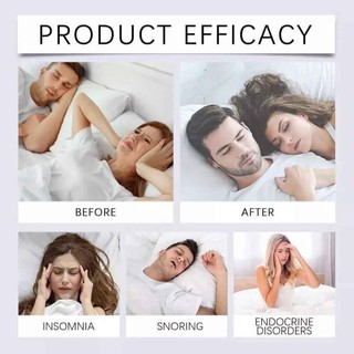 ​Noctivio Anti Snoring Mouth Tape Nose Breathing Improving Reduce Mouth Dryness Better Sleeping Closed Mouth Stickers