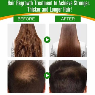 Batana Oil for Hair Growth, Batana Oil Organic Cold Press60ml