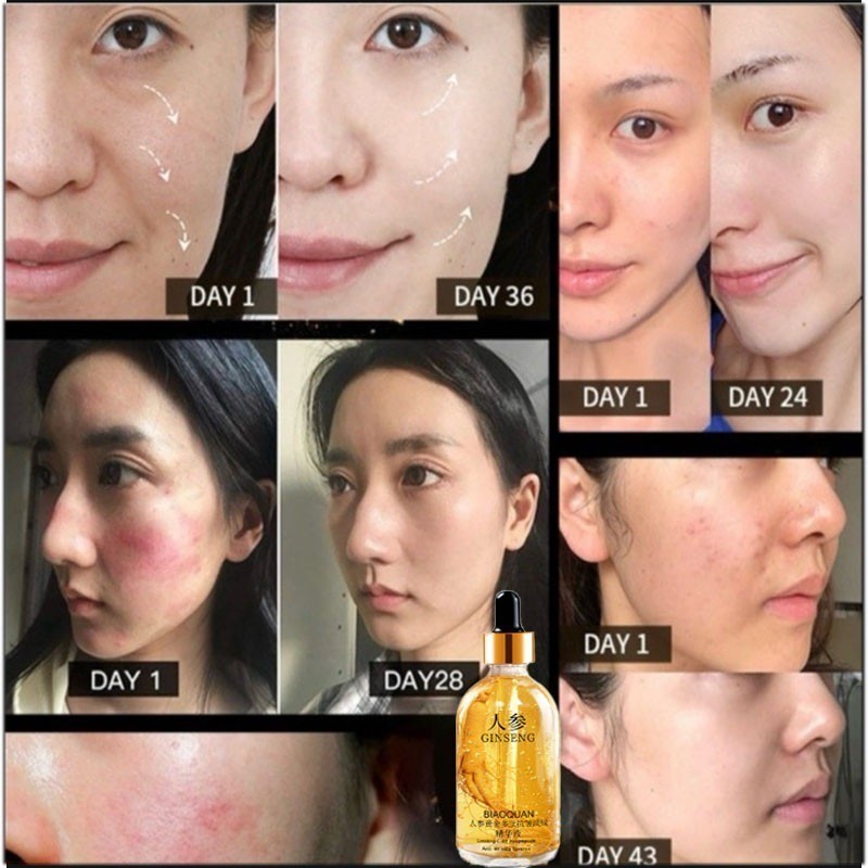 Tinh chất chống nhăn Polypeptide vàng nhân sâm chính hãng SEVICH