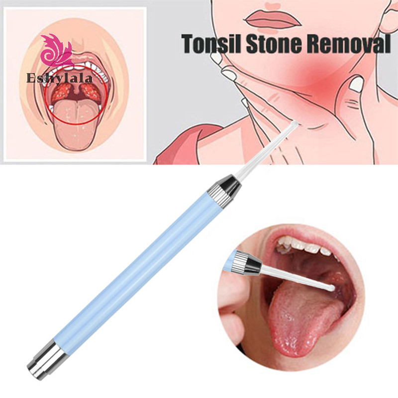 Công cụ loại bỏ đá Tonsil huỳnh quang Dụng cụ tẩy sáp tai Dụng cụ chăm sóc làm sạch miệng Dụng cụ tẩy đá Tonsil Chăm sóc sức khỏe [MỚI]