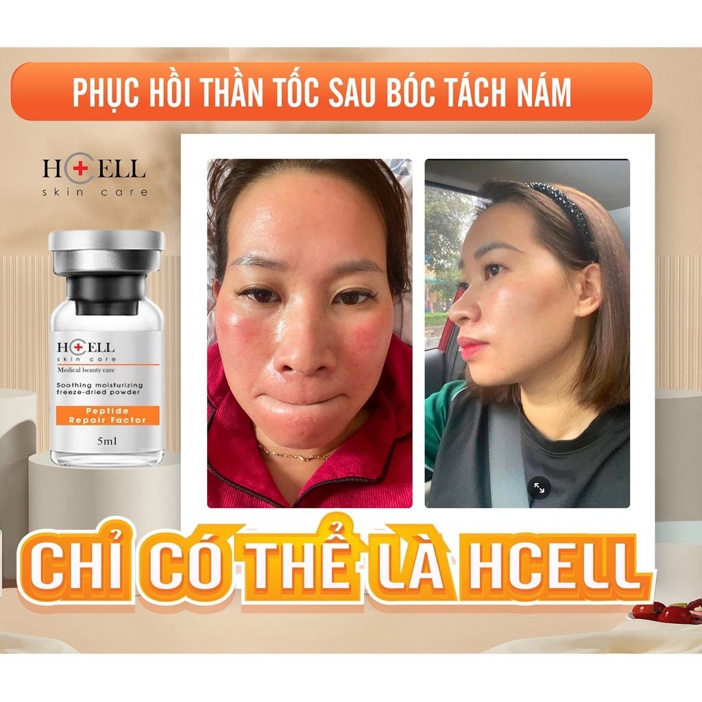 Tế bào gốc đông khô nuôi dưỡng phục hồi, tái tạo da Hcell