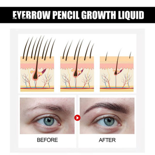 Cods 30ml Dung dịch tăng trưởng lông mày tự nhiên Tăng trưởng sợi dày đặc Bảo trì lông mày Nhân sâm chống dị ứng Chăm sóc lông mày An toàn hiệu quả Giải pháp chăm sóc lông mày mở rộng cho tôi