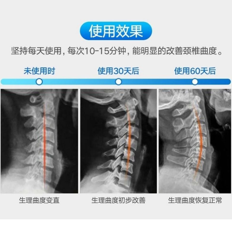 Gối hỗ trợ thắt lưng Fir, gối cứng bằng gỗ nguyên khối cho cột sống cổ, chỉnh sửa tư thế cho bệnh nhân, sửa chữa đặc biệt, kéo thẳng, chăm sóc sức khỏe EJBW