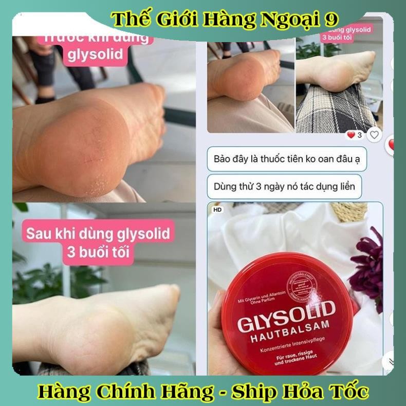 [auth] Kem dưỡng ẩm Glysolid Hautbalsam, 100 ml của Đức [Hot]