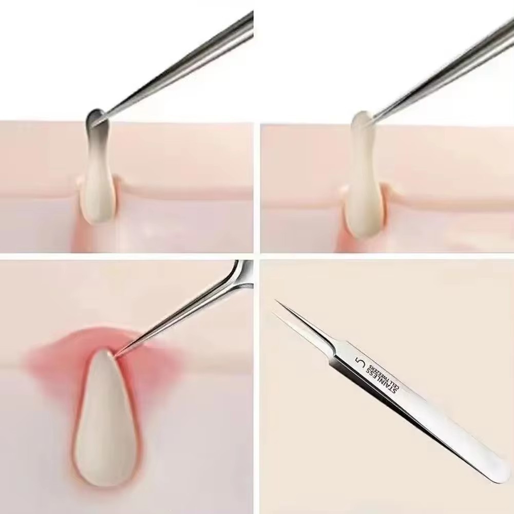 Bộ 4 Món Que Nặn Mụn Đầu Đen, Trứng Cá, Cám Thần Thánh Siêu Mịn Tế Bào Mụn Sạch Dụng Cụ
