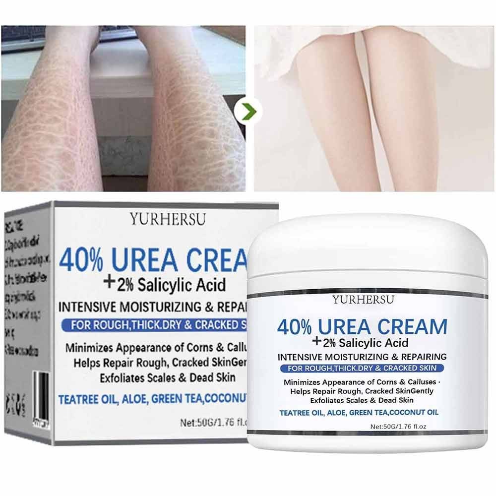 Urea Cream 40% Plus Salicylic Acid 50ml, Callus Remover Hand Cream Foot Cream Body Skin Care Tools